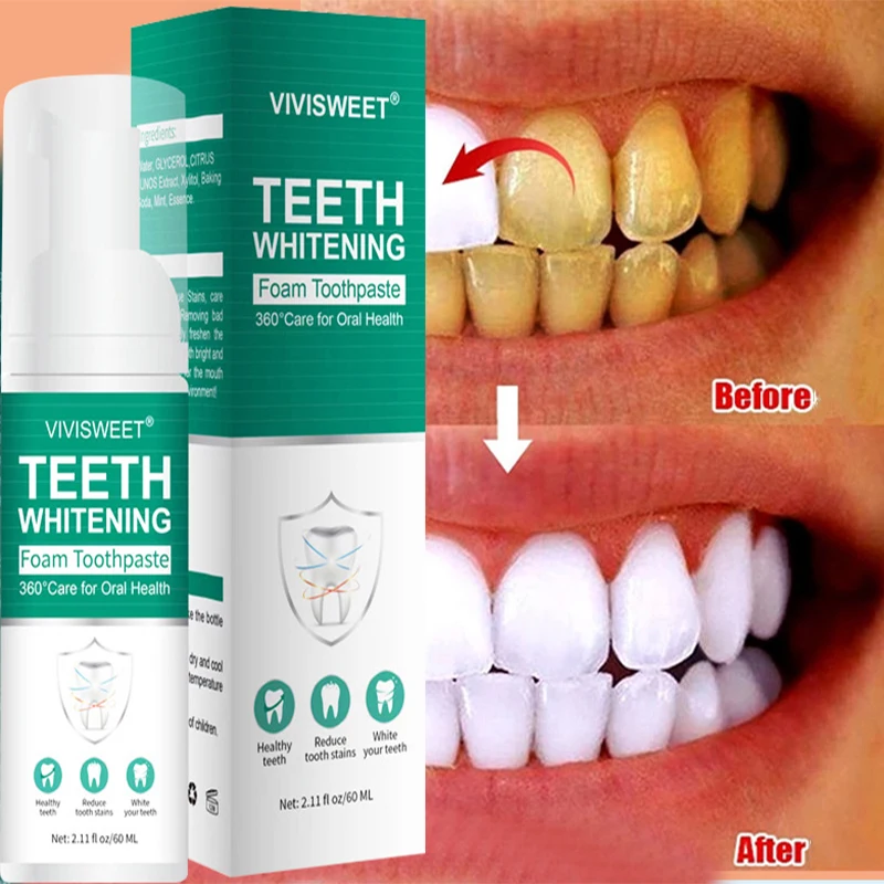 

Teeth Whitening Mousse Dental Care Essence Remove Plaque Tooth Stain Gingival Repair Caries Prevention Oral Cleaning Products