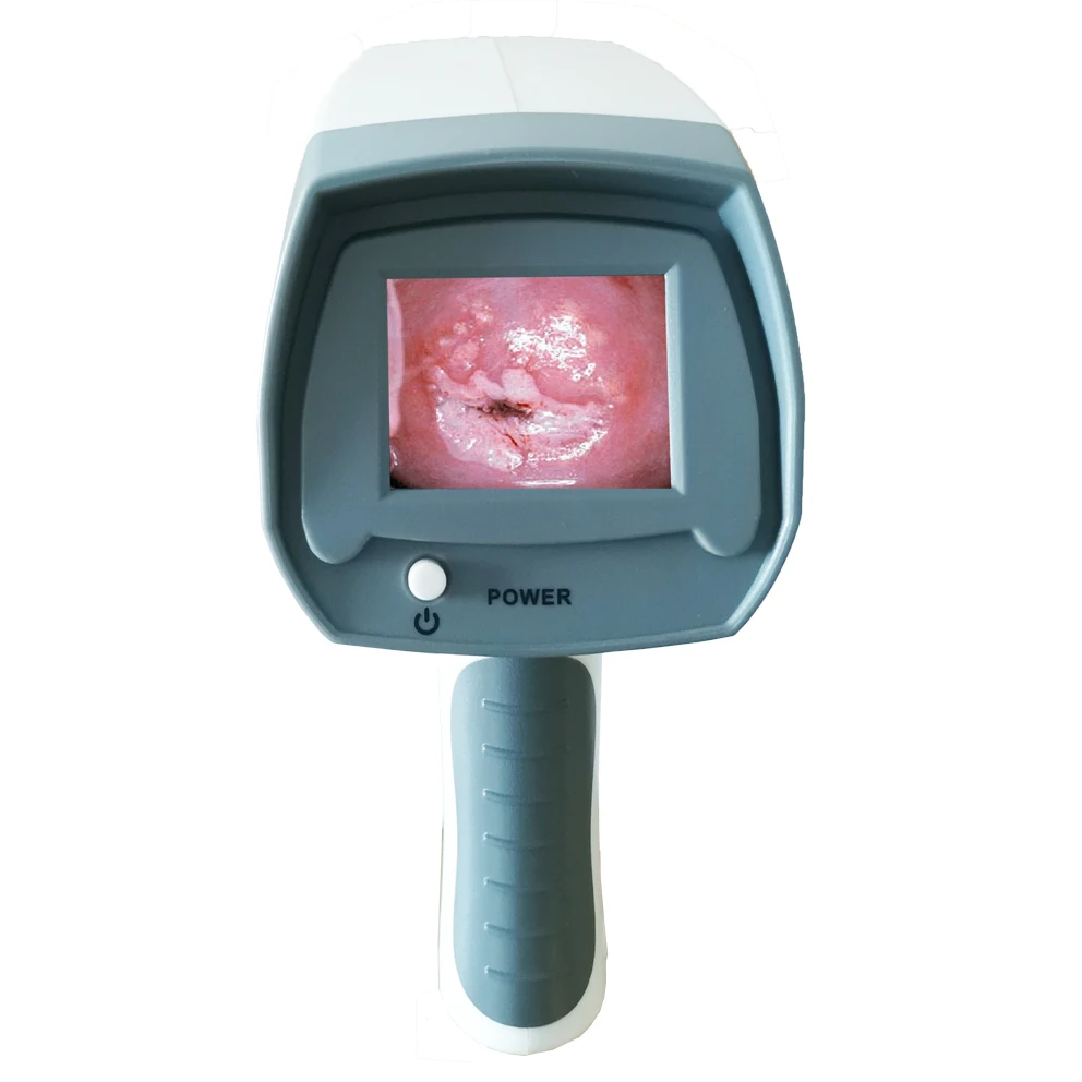 Медицинское оборудование по заводской цене, электрическая система Colposcopy, цифровая вагинальная видеокамера Hd для гинекологии
Медицинское оборудование по заводской цене, электрическая система Colposcopy, цифровая вагинальная видеокамера Hd для гинекологии