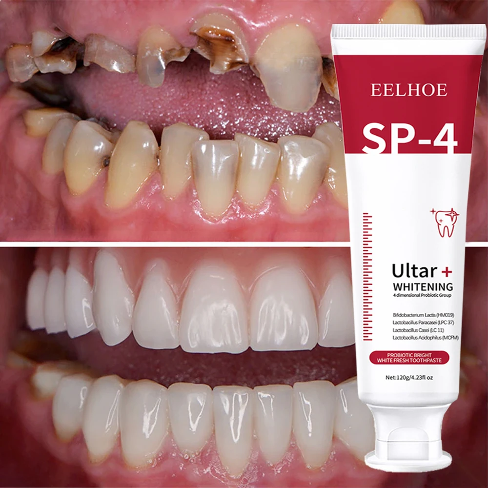 

Probiotic Caries SP 4 Toothpaste Tooth Whitening Decay Repair Paste Teeth Cleaner Plaque Remover Fresh Breath Dental Care 120g