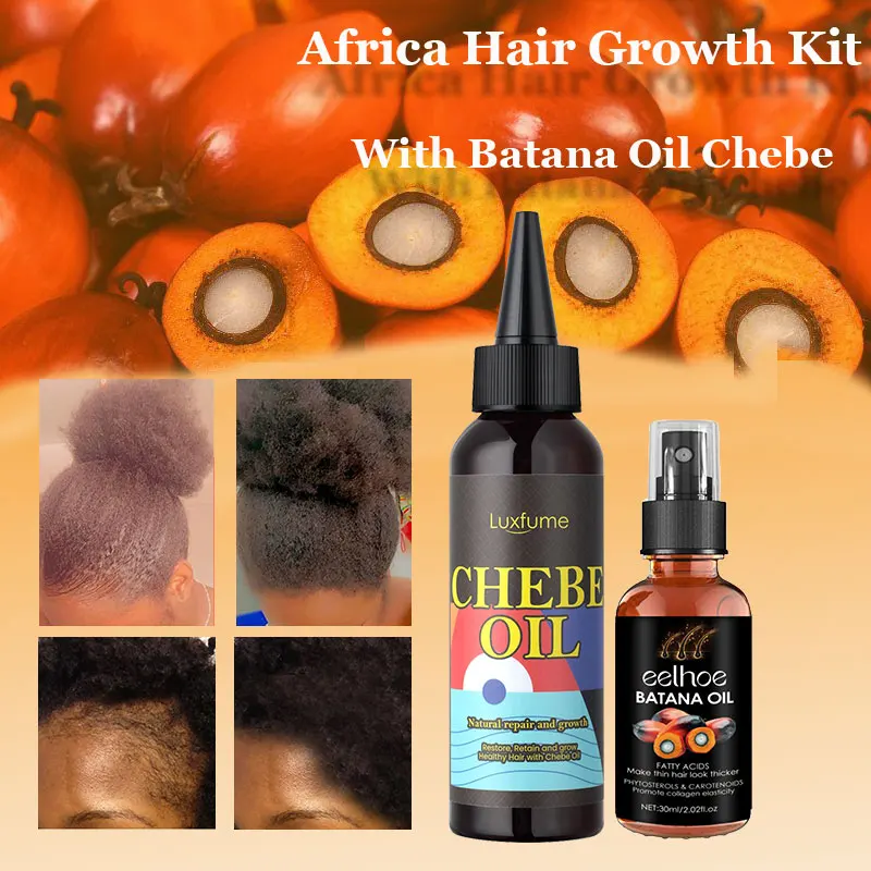 

Масло для волос 100 мл, масло для африканских женщин, средство для лечения алопеции, утолщенные масла для волос, масло для мужчин, бетана, спрей для роста волос, против выпадения волос