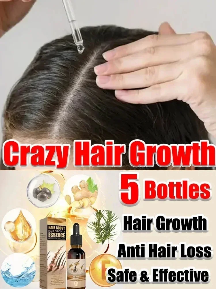 

Масло для роста волос унисекс для мужчин и женщин, эффективное средство для восстановления облысения, лечение против выпадения волос