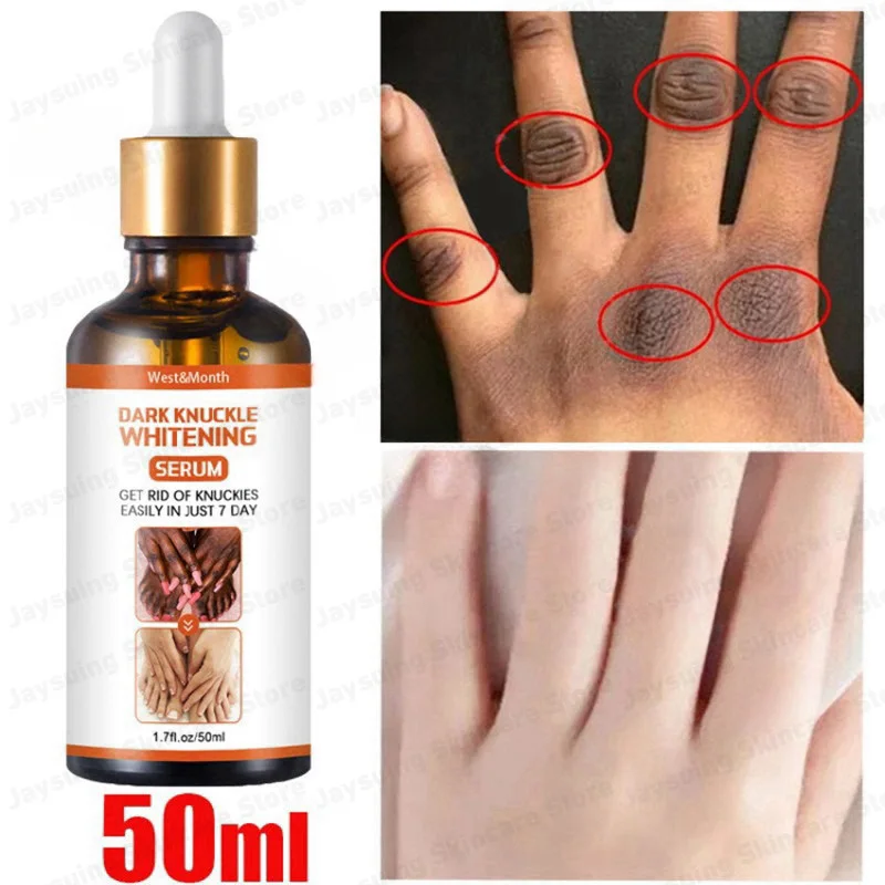 

Fast Whitening Hand Cream Moisture Intense Anti Black Remover Hand Knuckle Elbows Knee Melanin Corrector Serum Beauty Care 50ml