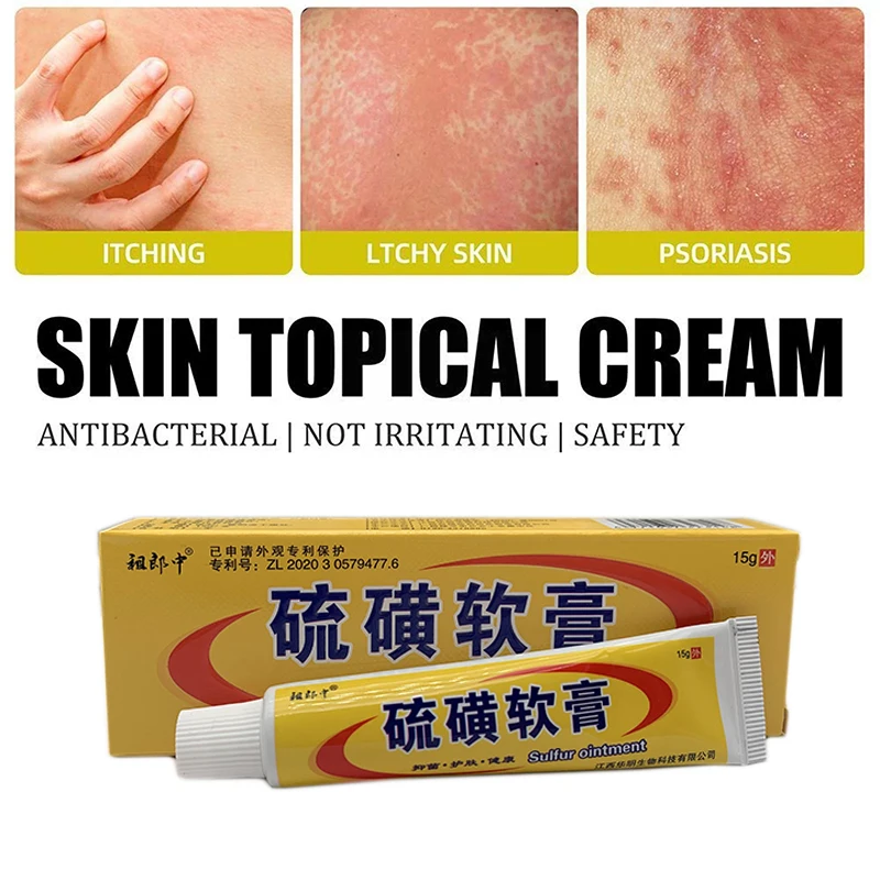 15G/Pcs Sulfur Antibacterial Cream Psoriasis Eczema Anti-itch Skin Desquamation Body Care Rash Urticaria Ointment Relief
15G/Pcs Sulfur Antibacterial Cream Psoriasis Eczema Anti-itch Skin Desquamation Body Care Rash Urticaria Ointment Relief