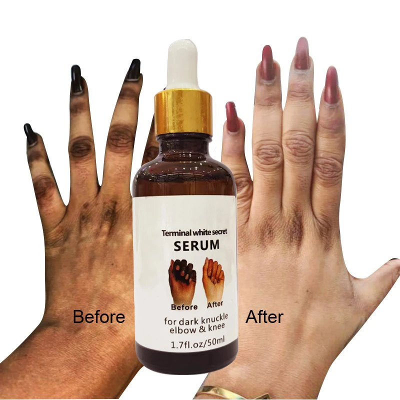 

1 Pcs Hand Blackening and Brightening Moisturizing Original Solution 50ml Whitening