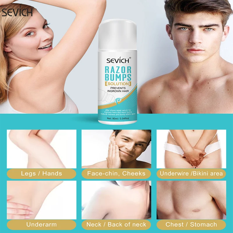 Sevich Unisex Razor Bumps Solution 90ml Prevents Ingrown Hair After Shave Repair Serum Shave Dark Spot Remover Mild
Sevich Unisex Razor Bumps Solution 90ml Prevents Ingrown Hair After Shave Repair Serum Shave Dark Spot Remover Mild