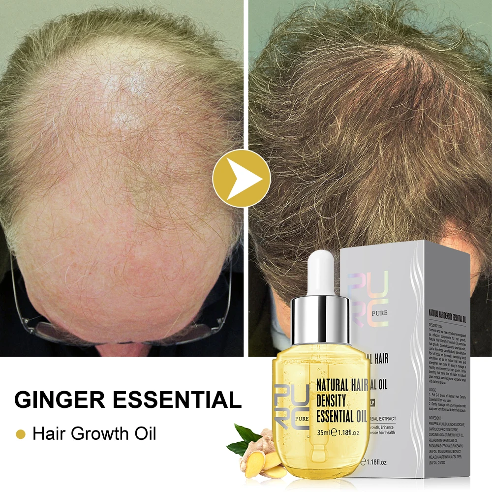 

Hair Growth Products Men Women Ginger Fast Regrowth Oil Anti Hair Loss Scalp Treatment Serum Thicken Grow Hair Care Oil PURC