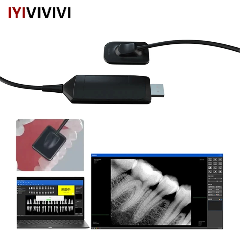 

Dentistry Digital Cameras Dental X-Ray Sensor High-Frequency Rx Digital Intraoral Digital System H D Image Radiovisografo Tools