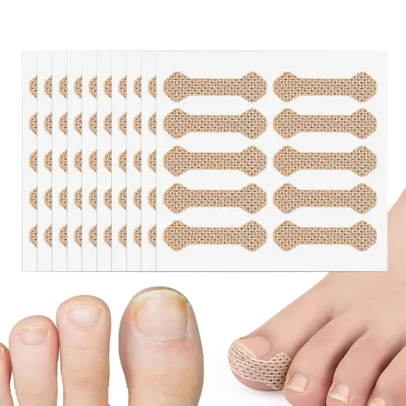 Toenail Correction Stickers Toenail Repair Corrector Patches For Nail Renewal Breathable Non-Irritating Nail Repair Renewal 
Toenail Correction Stickers Toenail Repair Corrector Patches For Nail Renewal Breathable Non-Irritating Nail Repair Renewal