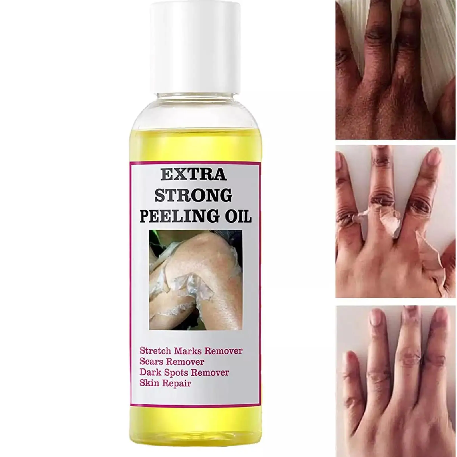 

2PCS 110ML Extra Strong Yellow Peeling Oil Whitening Lighten Elbows Knees Hands Even Skin Tone Whiten Skin Care