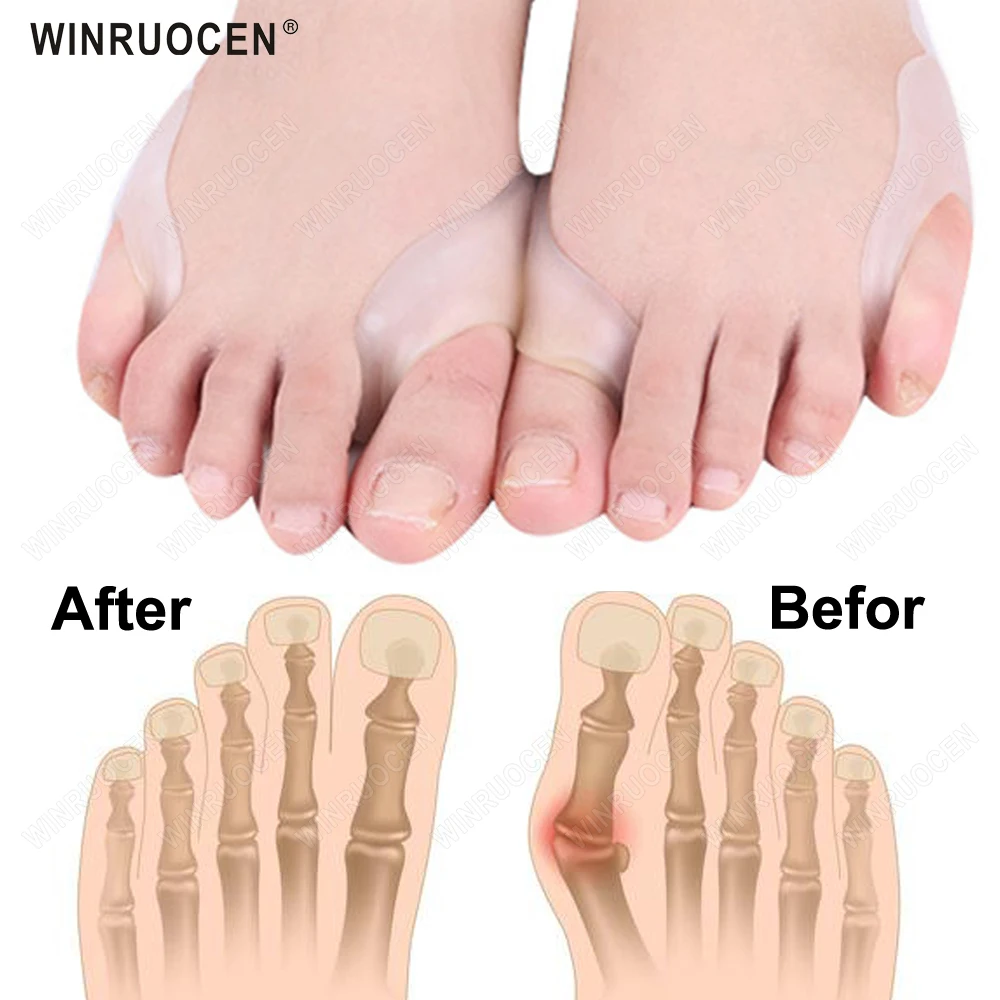 Big Toe Foot Silicone Orthopedic Hallux Valgus Corrector Adjuster Correction belt Finger Pain Relief Pedicure Foot Care Tool
Big Toe Foot Silicone Orthopedic Hallux Valgus Corrector Adjuster Correction belt Finger Pain Relief Pedicure Foot Care Tool