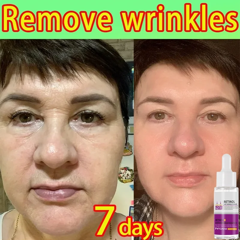 Wrinkle Remover Serum Niacinamide Fade Face Fine Line Anti-Aging Serum Lifting Firming Whiten Nourish Korean Skin Care For Women
Wrinkle Remover Serum Niacinamide Fade Face Fine Line Anti-Aging Serum Lifting Firming Whiten Nourish Korean Skin Care For Women