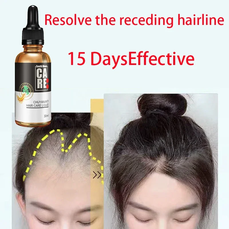 Anti hair loss and hair growth liquid for hair growth, dense hair, and hair fixing herbal plant extract hair essence
Anti hair loss and hair growth liquid for hair growth, dense hair, and hair fixing herbal plant extract hair essence