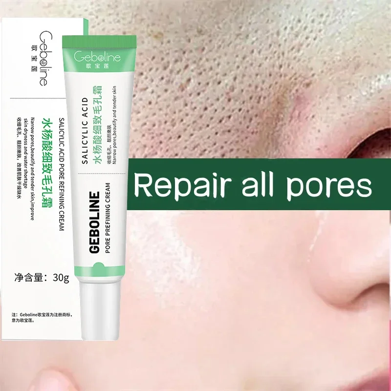 Salicylic Acid Pore Shrinking Cream Quick Elimination Large Pores Remove Blackehead Tighten Face Smooth Skin Korean Care Product
Salicylic Acid Pore Shrinking Cream Quick Elimination Large Pores Remove Blackehead Tighten Face Smooth Skin Korean Care Product