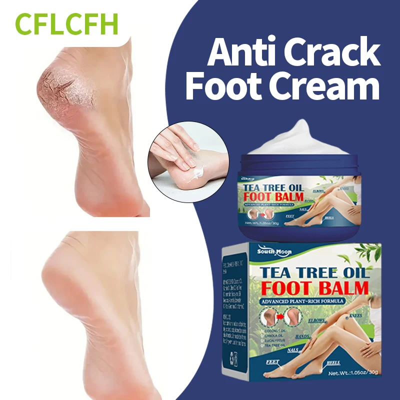 

Anti Crack Foot Cream Hand Heel Dead Skin Removal Ointment Drying Cracked Feet Repair Moisturizing Emollient Peeling Foot Care
