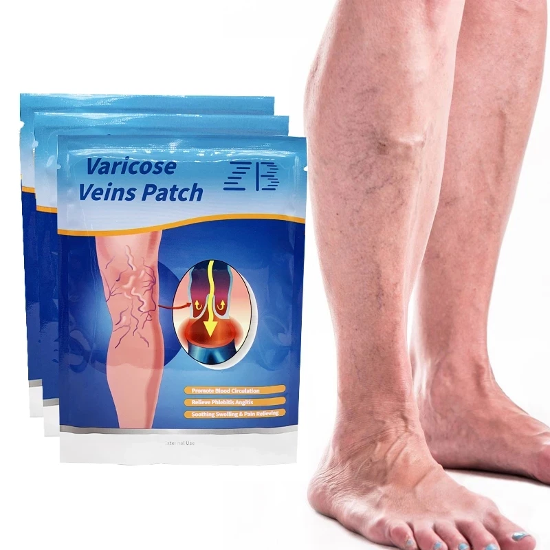 

6pcs ZB Varicose Veins Patch Treatment For Varicose Veins Vasculitis Phlebitis Spider Leg Medical Patch Angiitis Removal Patch