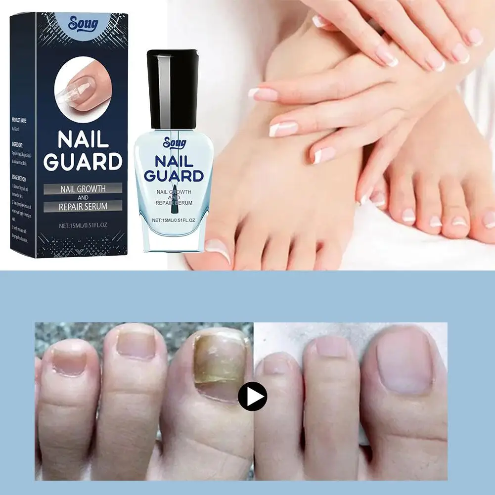Nail Repairing Liquid Nail Strengthener Nourishing Cream Soft Shining Nail Repair Serum For Home Finger Toe Nail Care D2O6
Nail Repairing Liquid Nail Strengthener Nourishing Cream Soft Shining Nail Repair Serum For Home Finger Toe Nail Care D2O6