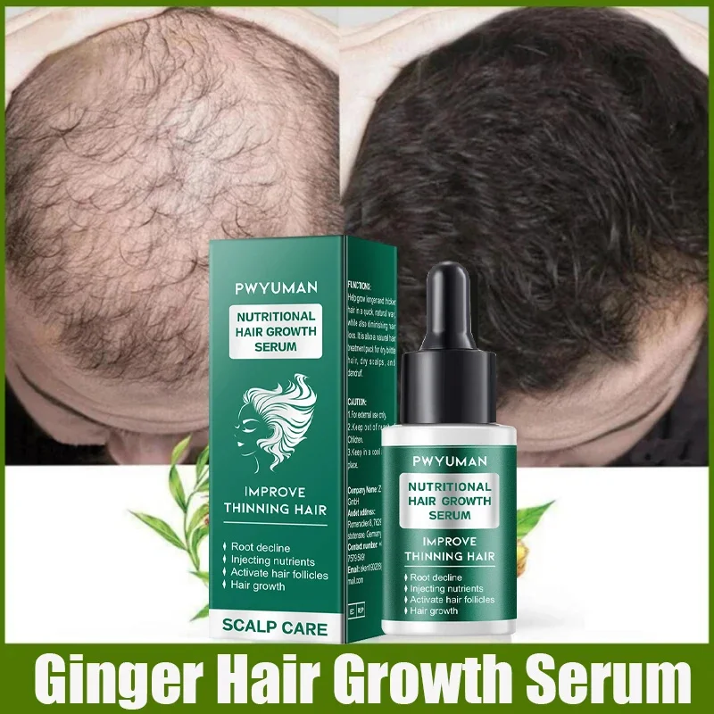 

Natural Ginger Hair Growth Spray Hair Roots Fast Grow Anti Hair Loss Serum Liquid Scalp Damaged Treatment Repair Beauty Health