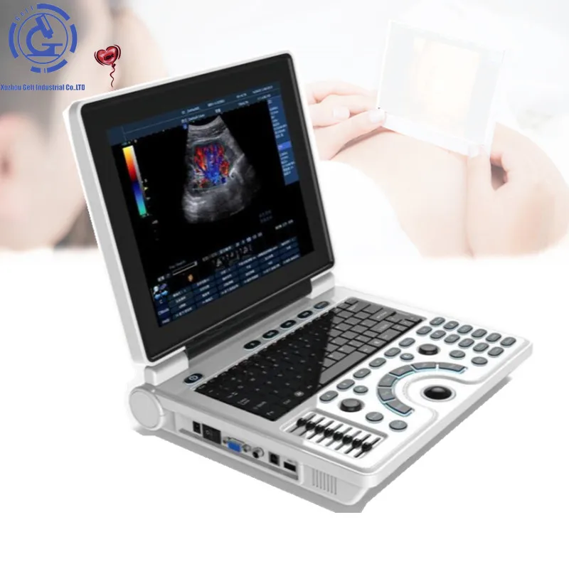 Ultrasound scanner For Veterinary Human Sonostar Portable Laptop Ultrasound Machine
Ultrasound scanner For Veterinary Human Sonostar Portable Laptop Ultrasound Machine