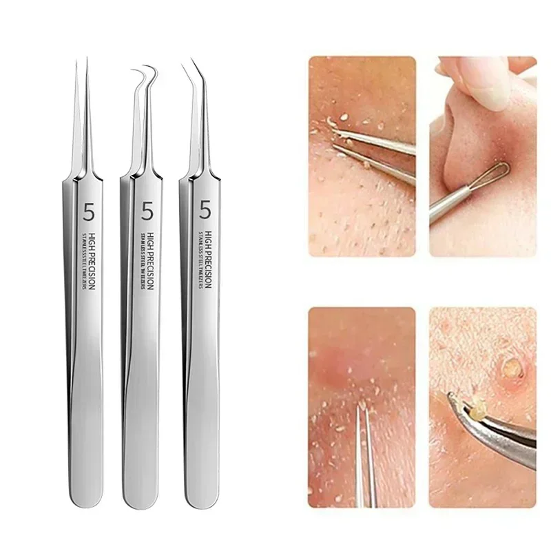 Ultra-Fine No. 5 Cell Pimples Blackhead Clip Tweezers Beauty Face Health Salon Special Blackhead Remover Acne Needle Tool
Ultra-Fine No. 5 Cell Pimples Blackhead Clip Tweezers Beauty Face Health Salon Special Blackhead Remover Acne Needle Tool