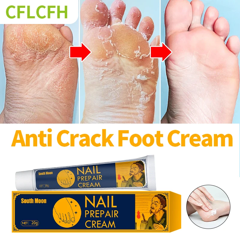 

Anti Crack Foot Cream Moisturizing Emollient Mask Hand Heel Dead Skin Removal Peeling Drying Cracked Feet Repair Foot Care