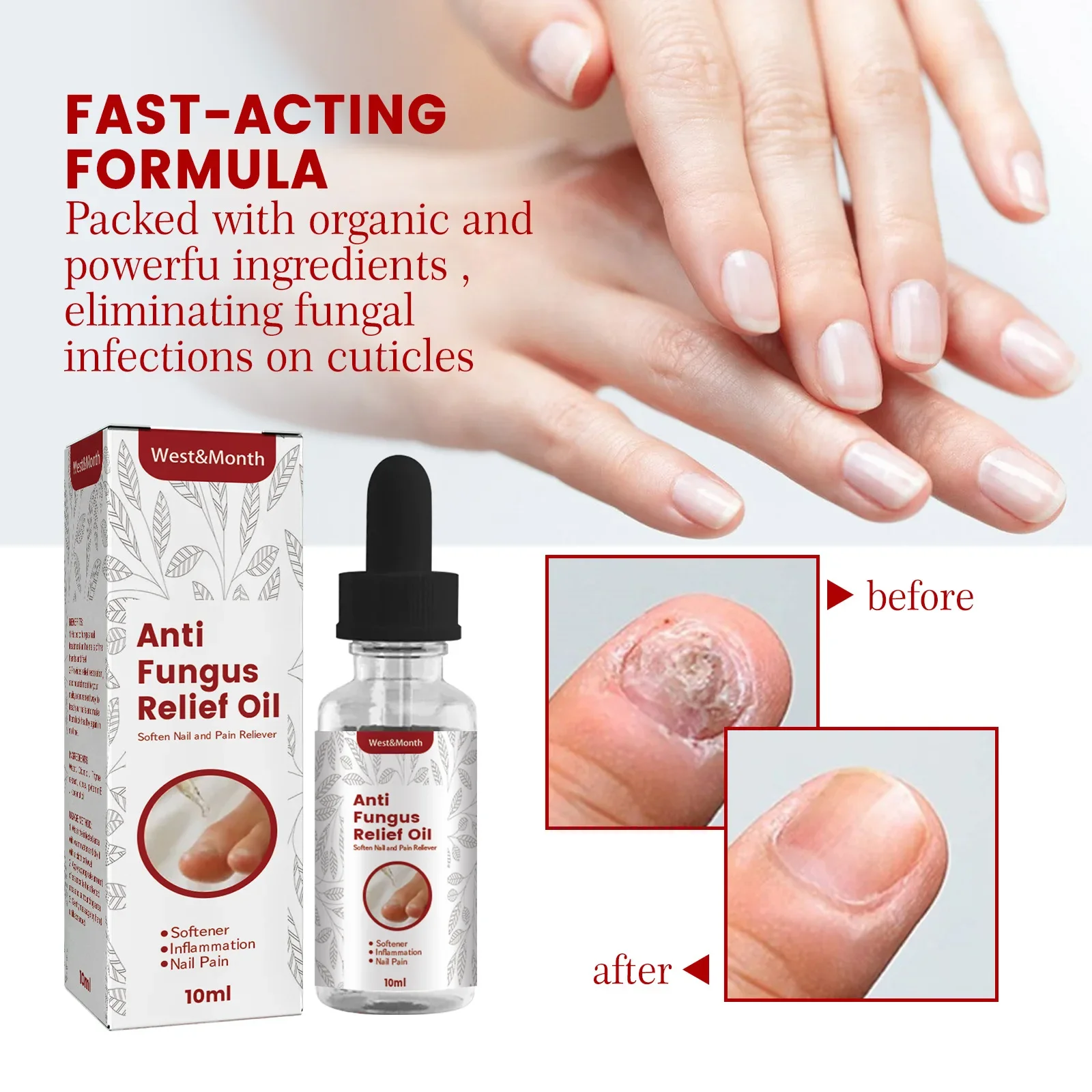 Grey Nail Repair Liquid Concave Thick Nail Removal Soft Nail Brightening Repair Liquid
Grey Nail Repair Liquid Concave Thick Nail Removal Soft Nail Brightening Repair Liquid