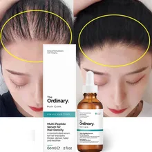 Ordinary Hair Growth Essential Oils Care Essence Hair Loss Liquid Peptide Treatment Hair Growth Serum Original Authentic 60ml
Ordinary Hair Growth Essential Oils Care Essence Hair Loss Liquid Peptide Treatment Hair Growth Serum Original Authentic 60ml