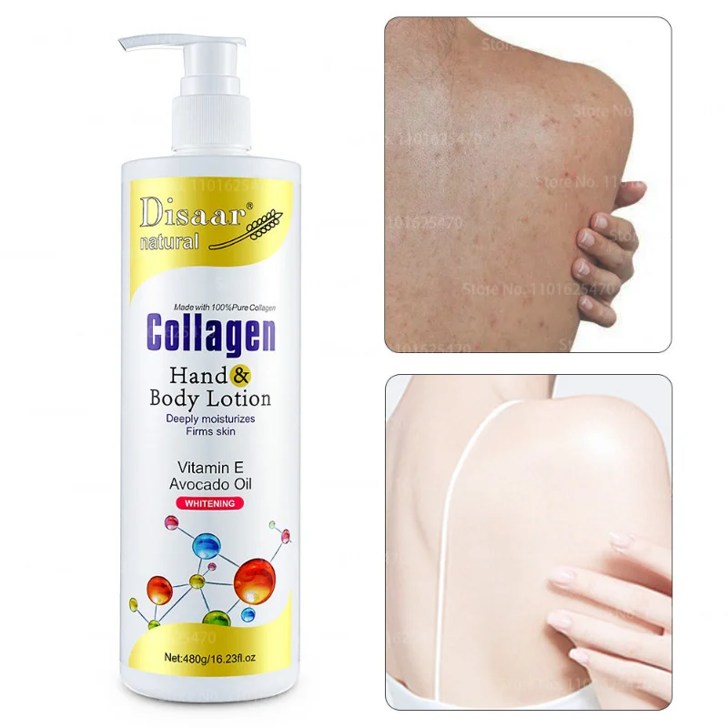 Collagen Bleaching Face Body Cream VE Whitening Cream Skin Whitening Moisturizing Body Lotion Skin Lightening Cream Body Care
Collagen Bleaching Face Body Cream VE Whitening Cream Skin Whitening Moisturizing Body Lotion Skin Lightening Cream Body Care