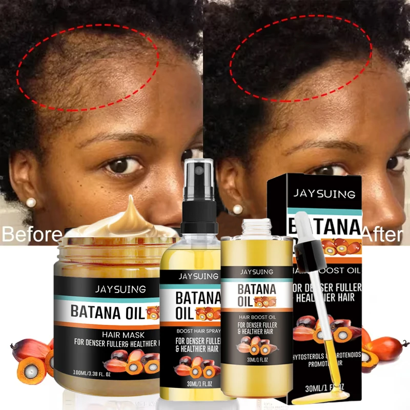 Fast Hair Growth Set Batana Oil Traction Alopecia HairS Mask Anti Break Loss Hair Growth Oil Baldness Treatment Hair Health Care 10 S2effd445aaef4a7c814b94c912b56335f