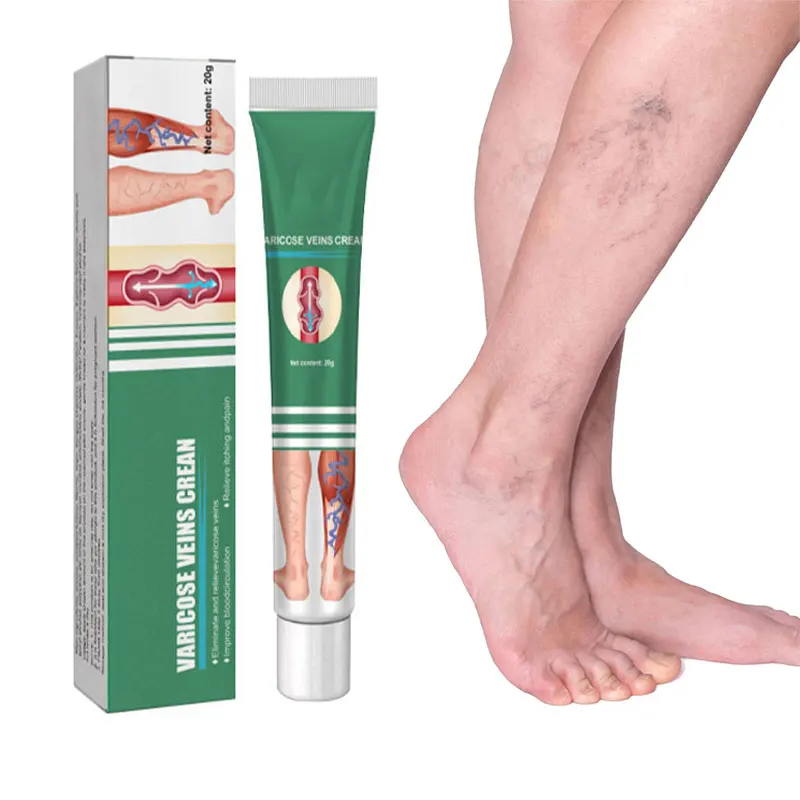 

Ointment for Varicose Veins Effective Varicose Vein Relief Cream to Relieve Vasculitis Phlebitis Spider Pain Treatment