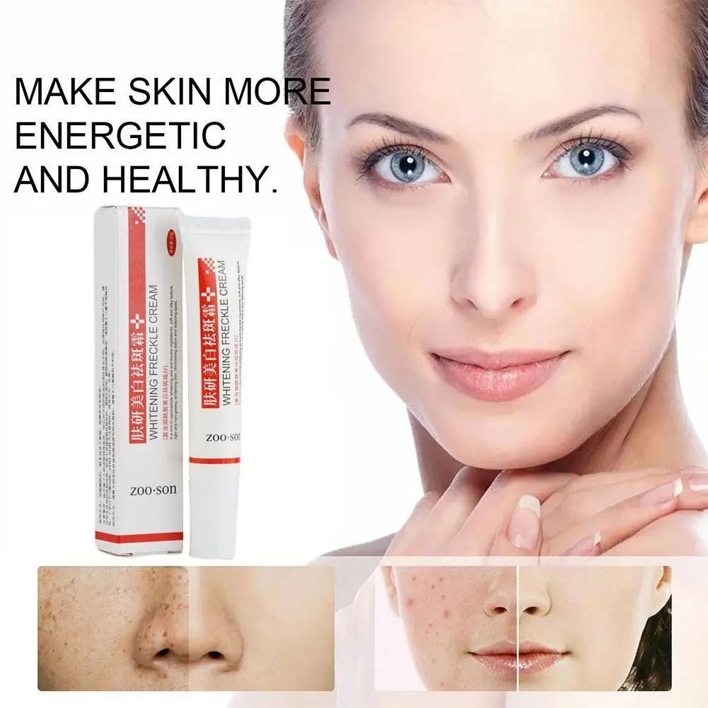 20ml Face Skin Care Effective Whitening Freckles Cream Moisturizing Brightening Remove Melasma Dark Spots Lighten Remover
20ml Face Skin Care Effective Whitening Freckles Cream Moisturizing Brightening Remove Melasma Dark Spots Lighten Remover