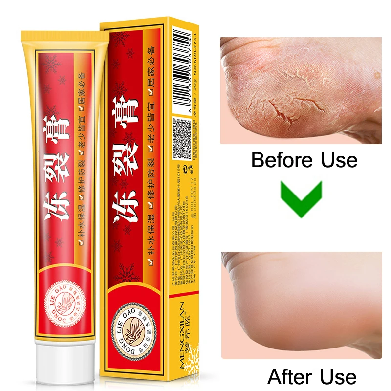 

Repairing Moisturizer Foot Cream Anti-chapping Skin For Rough Dry Cracked Chapped Feet Heel Hand Foot Cleft Healing Useful Oil