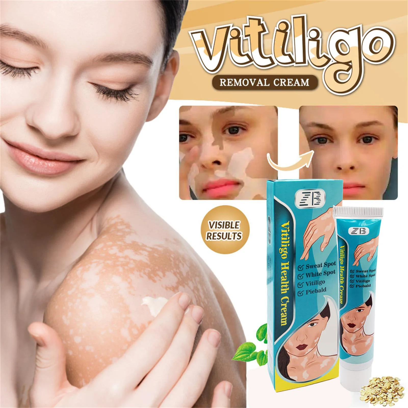 20g Vitiligo Removal Cream Natural White Spot Soothing Dressing Health Care Fast Acting Leukoplakia Vitiligo Repair Ointment
20g Vitiligo Removal Cream Natural White Spot Soothing Dressing Health Care Fast Acting Leukoplakia Vitiligo Repair Ointment