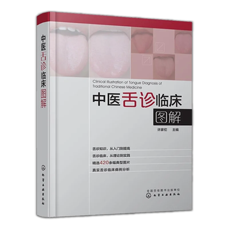 

illustration of tongue diagnosis in traditional Chinese Medicine Book