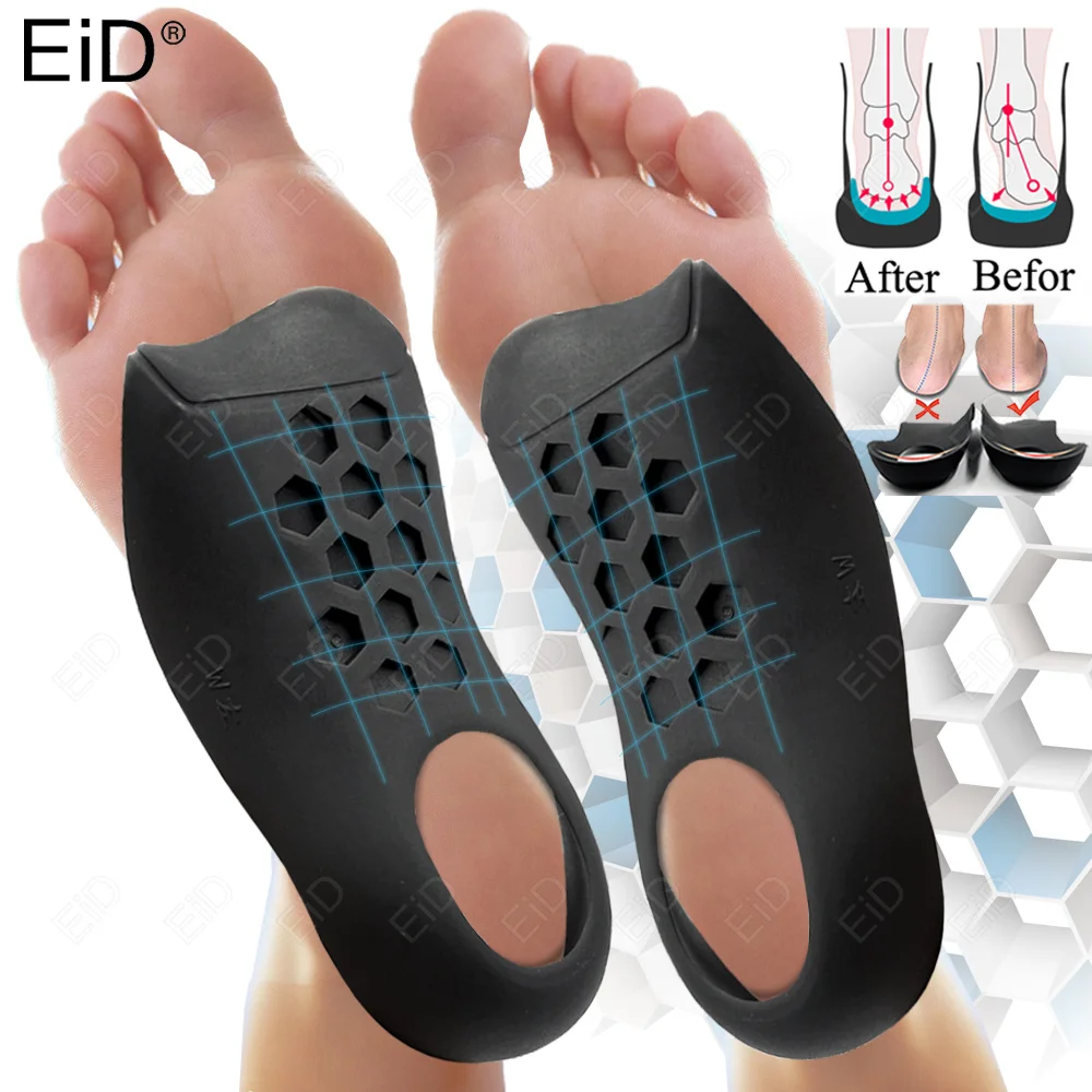 

EiD Orthotic Insoles for XO-Legs Correction Orthopedic Flat Feet Heel Pain Arch Support For Man Woman Shoe Insoles Sole Insert