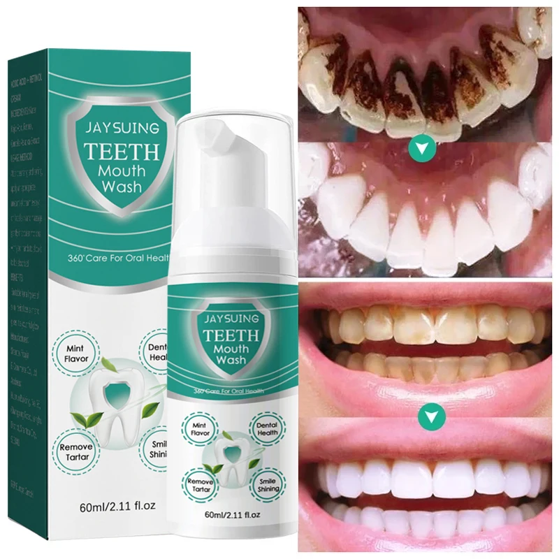 

Tooth Deep Cleansing Mousse 60ml Teeth Whitening Foam Toothpaste Remove Tartar Stain Reduce Yellowing Care For Gums Fresh Breath