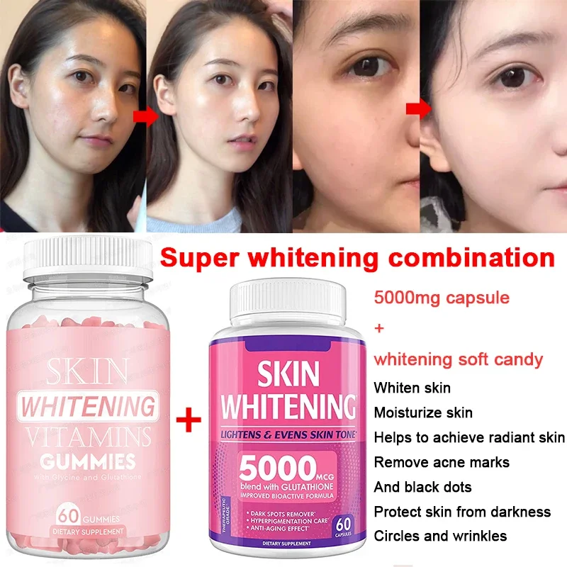 Glutathione Gummies Brightening Gummies Skin+Whitening Glutathione capsule Natural Skin Face Body Reducing Melanin free shipping
Glutathione Gummies Brightening Gummies Skin+Whitening Glutathione capsule Natural Skin Face Body Reducing Melanin free shipping