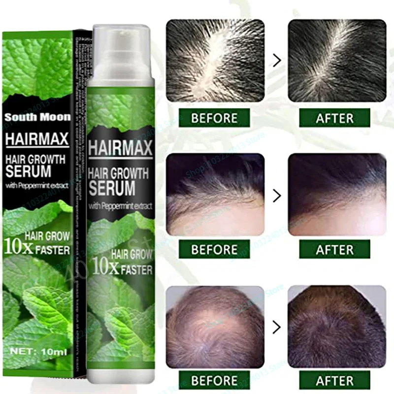 Натуральное масло для роста волос эффективное против выпадения волос питательное эфирное масло для густого восстановления поврежденных волос увлажняющее гладкое масло
Натуральное масло для роста волос эффективное против выпадения волос питательное эфирное масло для густого восстановления поврежденных волос увлажняющее гладкое масло