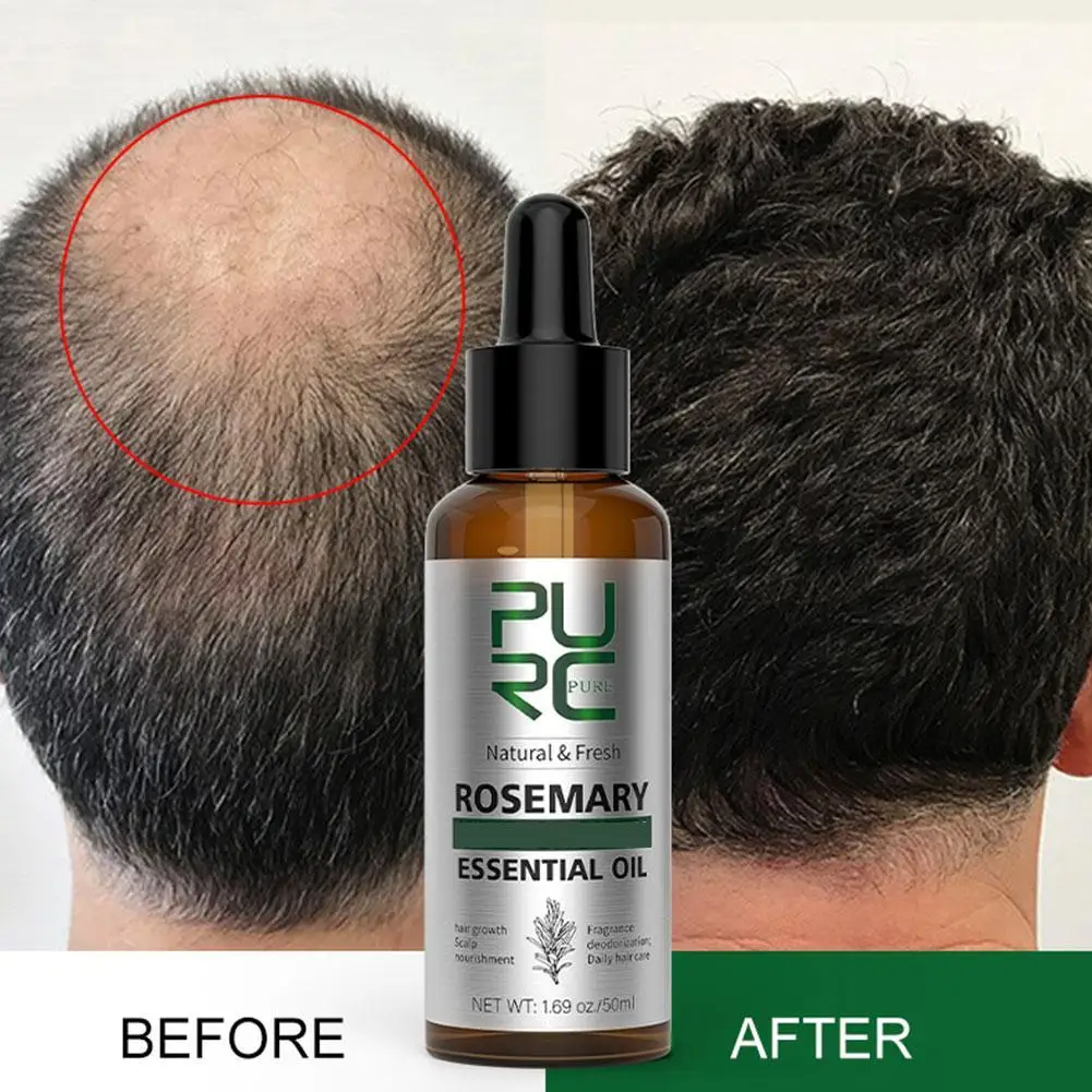 

50ml Rosemary Mint Split Ends Dry Nourishing Treatment Bald Strengthening Anti Hair Loss Essential Oil