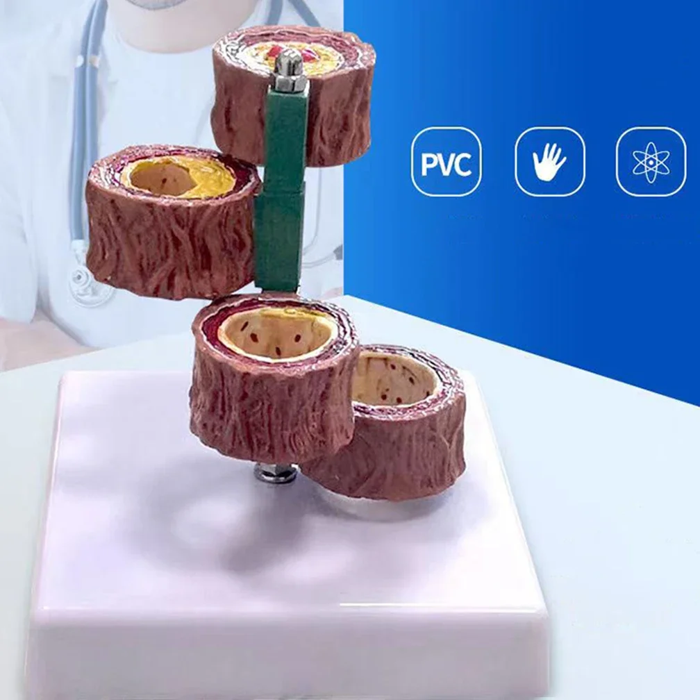 blood vessel model human arteries arteriosclerosis model medical gift anatomical tools 
blood vessel model human arteries arteriosclerosis model medical gift anatomical tools