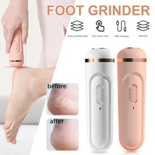Electric Foot Grinder Heel File Grinding Exfoliator Pedicure Machine Feet Hard Dead Skin Remove Professional File Care Tool
Electric Foot Grinder Heel File Grinding Exfoliator Pedicure Machine Feet Hard Dead Skin Remove Professional File Care Tool