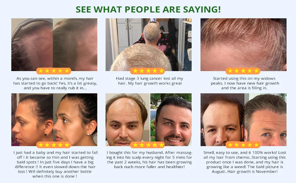 Fast Hair Growth Set Batana Oil Traction Alopecia HairS Mask Anti Break Loss Hair Growth Oil Baldness Treatment Hair Health Care 7 S379a79addd3e409c9a485ef0feceae7eX