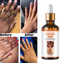 50m Whitening Serum Dark Strong Whitening Serum For Dark Knuckle Fingel To Remove Dark Knuckle Elbow And Kneel
50m Whitening Serum Dark Strong Whitening Serum For Dark Knuckle Fingel To Remove Dark Knuckle Elbow And Kneel