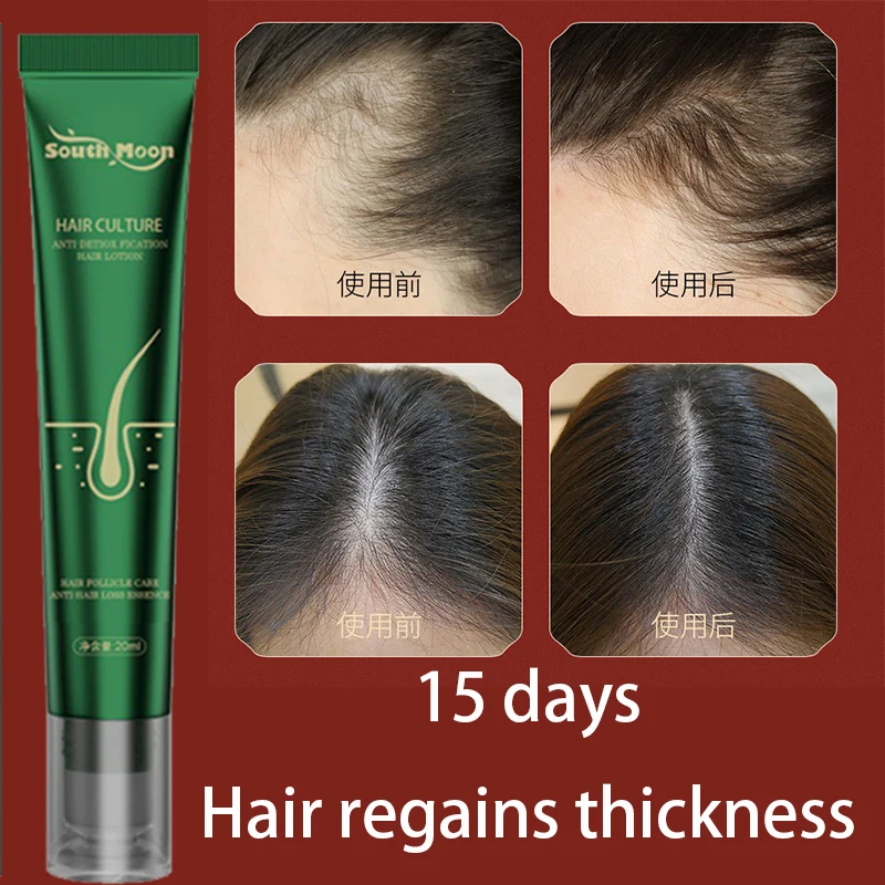 Anti hair loss and growth essence, strong hair, anti broken hair, root damage, repair ginger hair care essence
Anti hair loss and growth essence, strong hair, anti broken hair, root damage, repair ginger hair care essence