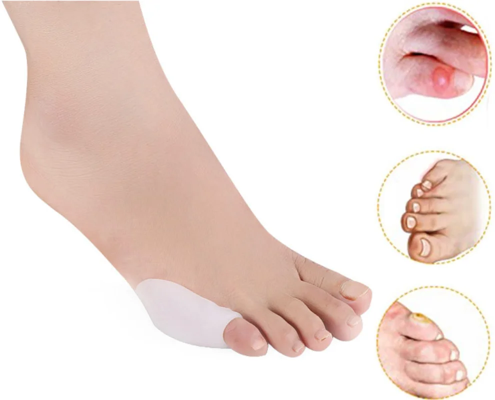 1Pair Gel Silicone Little Hammer Toe Overlapping Separators Protector Hallux Valgus Bunion Corrector Pain Relief Foot Care
1Pair Gel Silicone Little Hammer Toe Overlapping Separators Protector Hallux Valgus Bunion Corrector Pain Relief Foot Care