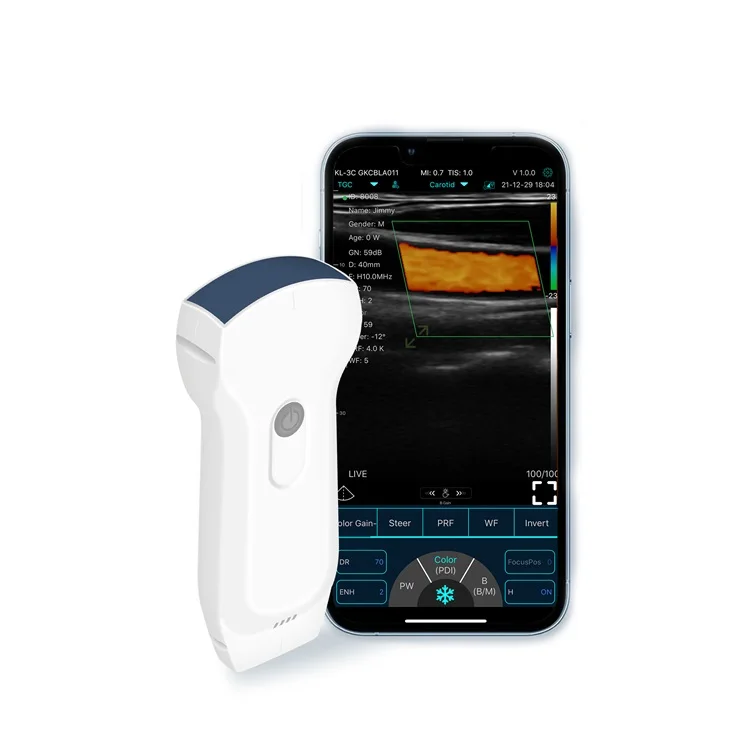 Cost-effective Double Probes Wireless Doppler Ultrasound Scanner Ultrasound Probe Handheld Device
Cost-effective Double Probes Wireless Doppler Ultrasound Scanner Ultrasound Probe Handheld Device