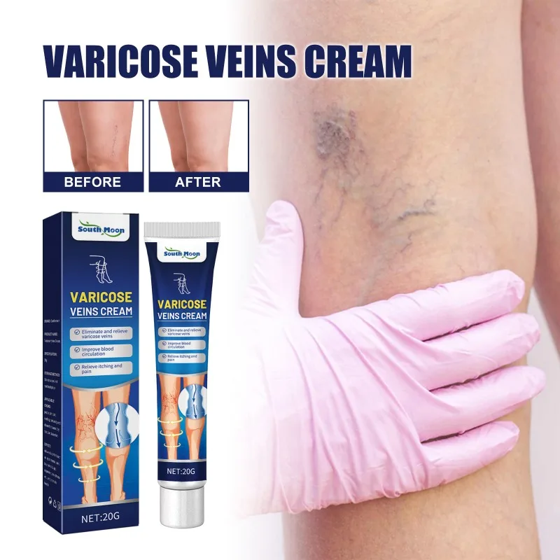20g Venous Massage Varicose Cream Relieves Leg Vascular Protrusion Varicose Veins Earthworm Leg Repair Care Cream
20g Venous Massage Varicose Cream Relieves Leg Vascular Protrusion Varicose Veins Earthworm Leg Repair Care Cream