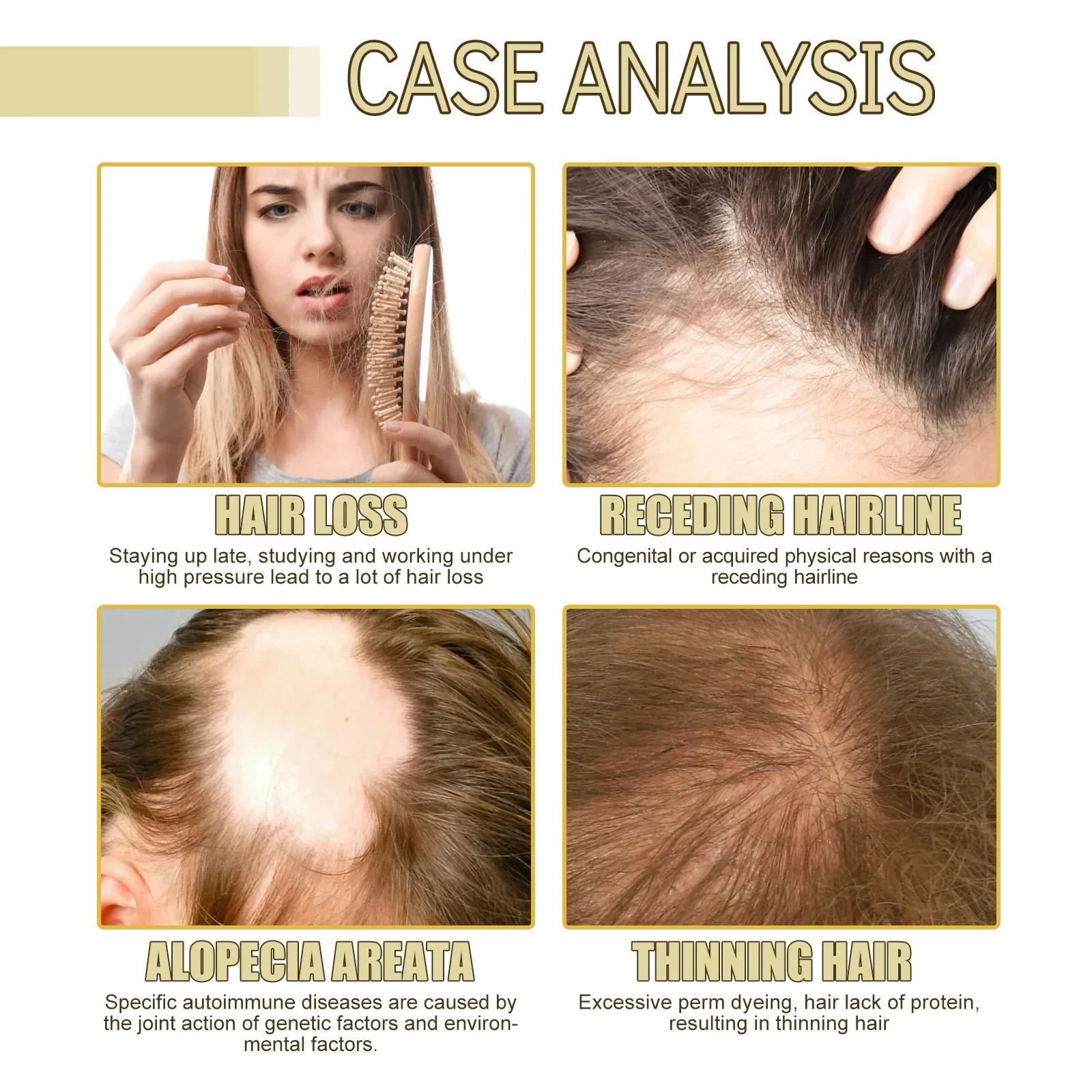

Fast Hair Growth for Men Women Hair Oil Care Ginger Anti Hair Loss Scalp Treatment Grow Serum Products Beauty Health