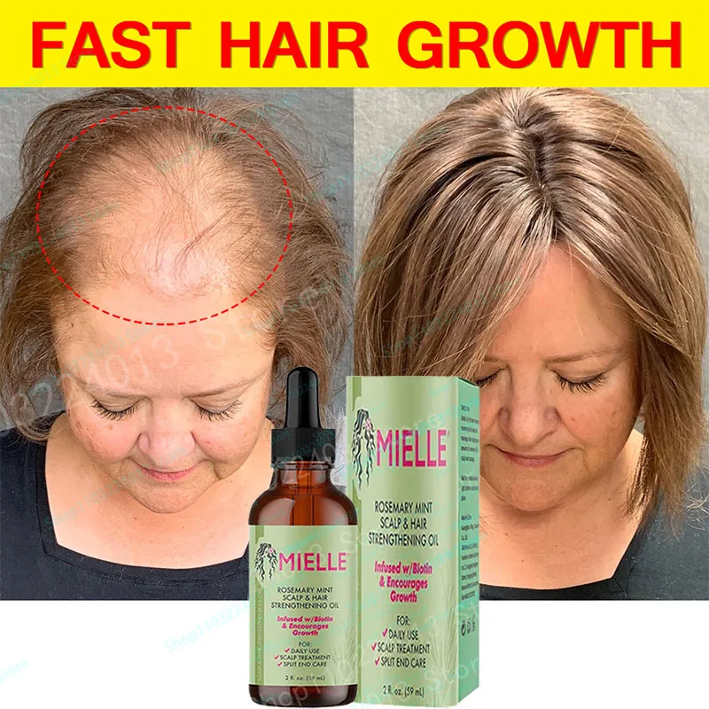 

Mielle Organics Rosemary Mint Scalp & Hair Strengthening Oil Infused w/Biotin and Encourages Growth