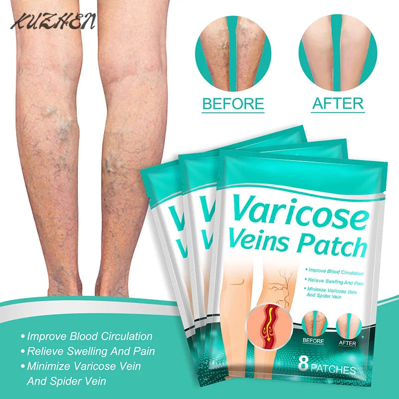 8 PCS Varicose Veins Patch Treatment For Varicose Veins Vasculitis Phlebitis Spider Leg Medical Patch Angiitis Removal Patch
8 PCS Varicose Veins Patch Treatment For Varicose Veins Vasculitis Phlebitis Spider Leg Medical Patch Angiitis Removal Patch