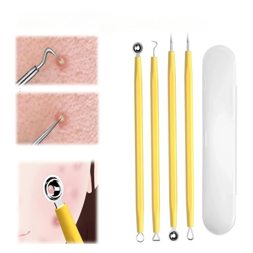 4PCS Acne Blackhead Comedone Black Spot Pimple Blemish Remover Skin Care Women Beauty Acne Treatment Pore Cleanser Needle Hook
4PCS Acne Blackhead Comedone Black Spot Pimple Blemish Remover Skin Care Women Beauty Acne Treatment Pore Cleanser Needle Hook